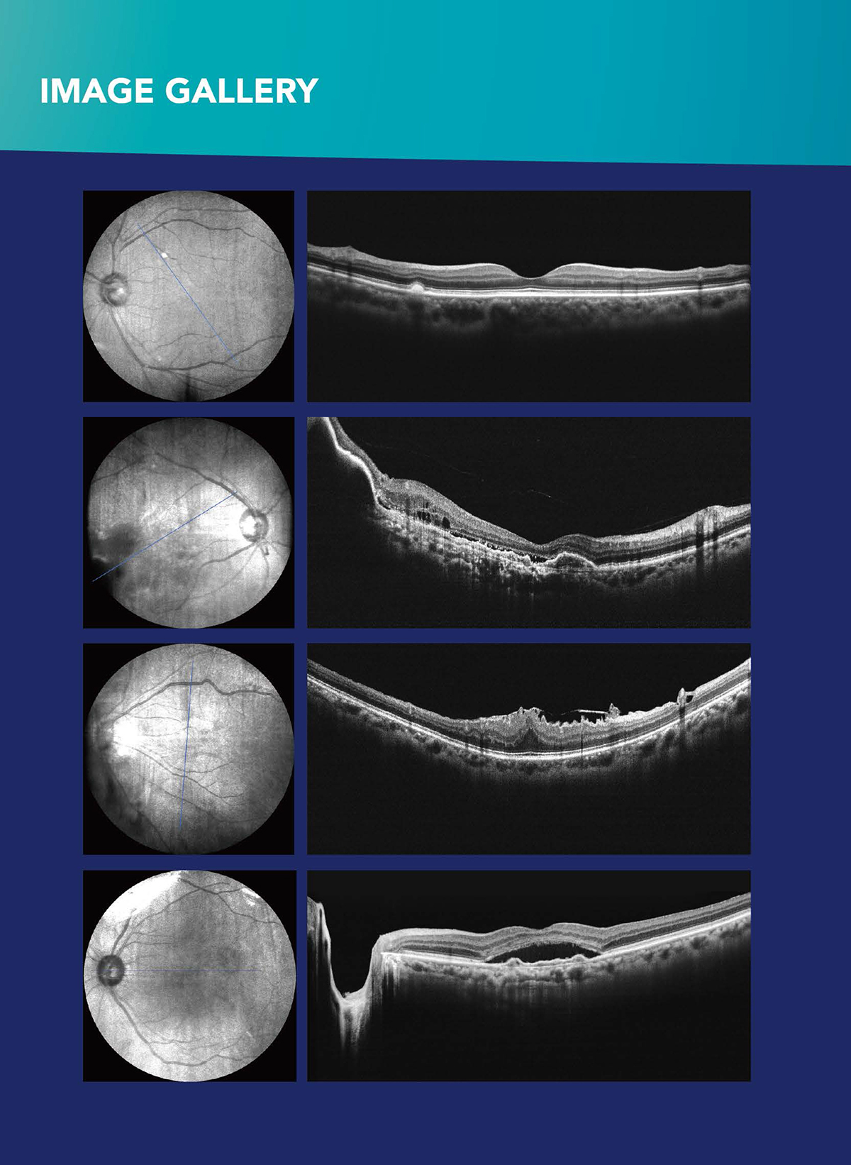 OSE3000 OCT Optical Coherence Tomography China Optical and