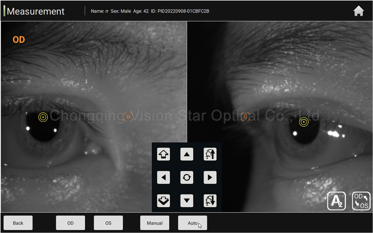 AL-View Optical Biometry Machine IOL Master China Wholesale