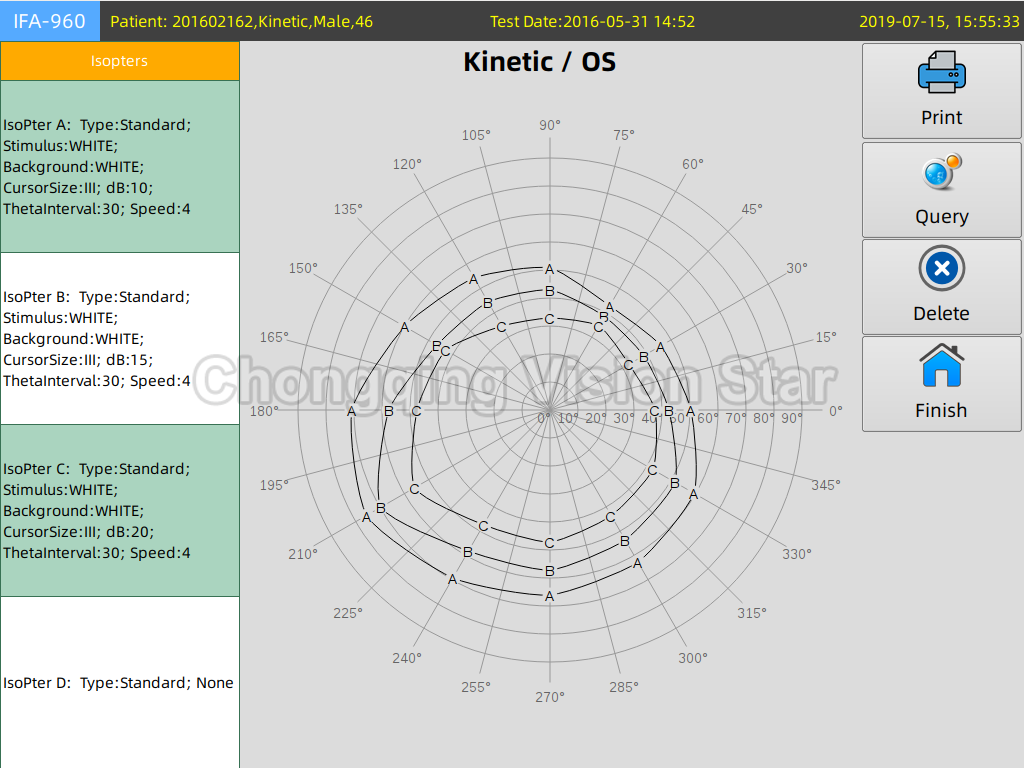 VF-960 Kinetic Perimetry 1