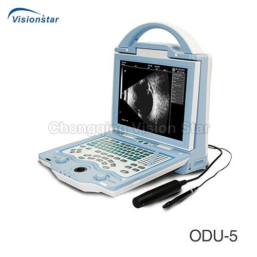 ODU-5 Ophthalmic A and B Scan