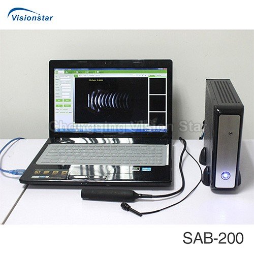 SAB-200 AB Scan