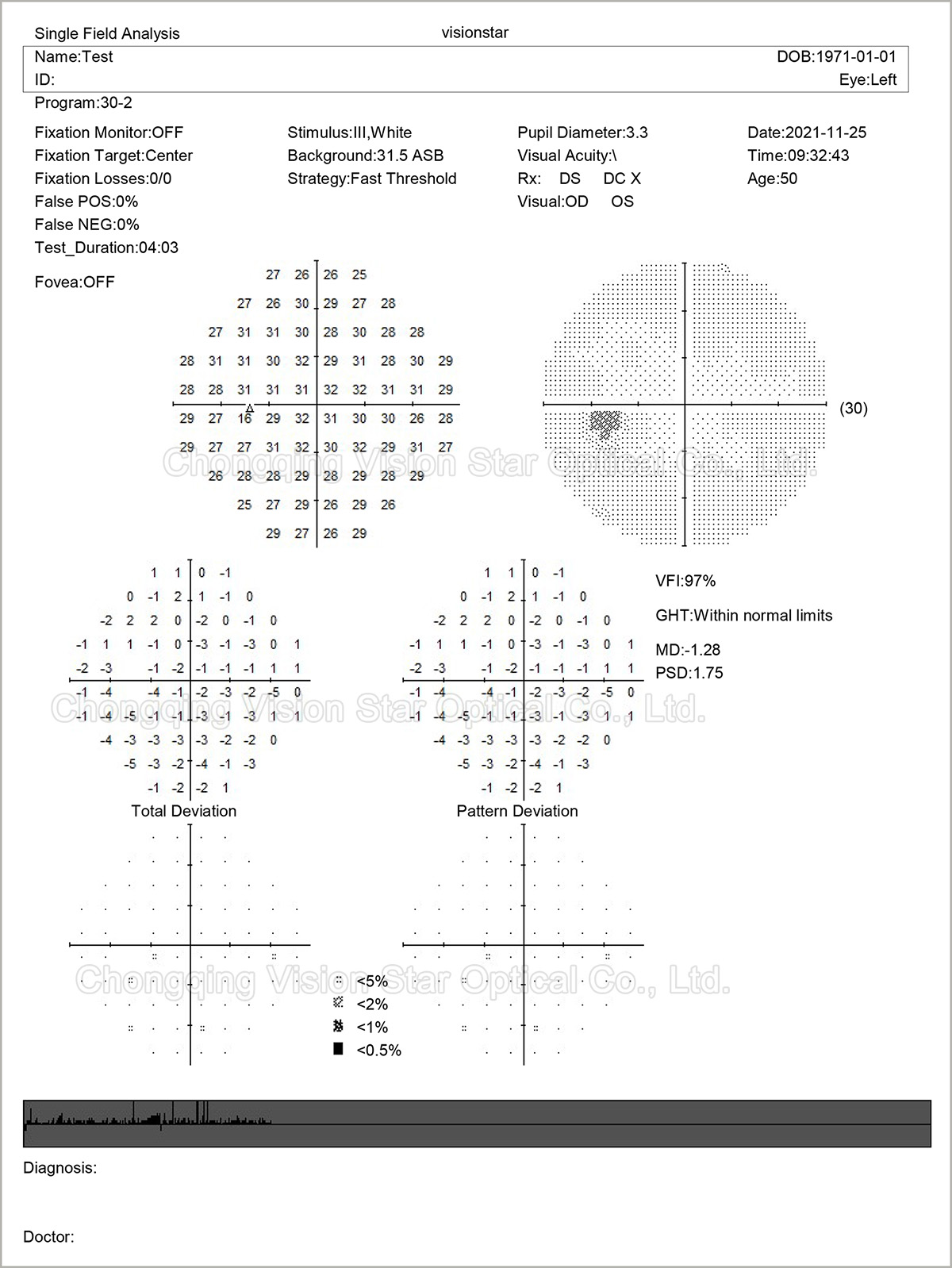 BIO-1000 Visual Field Analyzer Report
