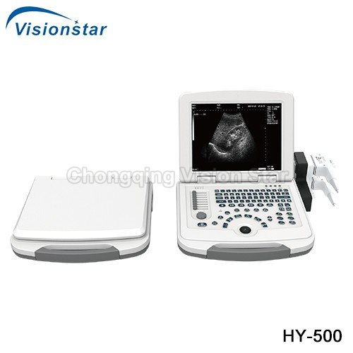 HY-500 Laptop Portable Black & White Ultrasound Scanner