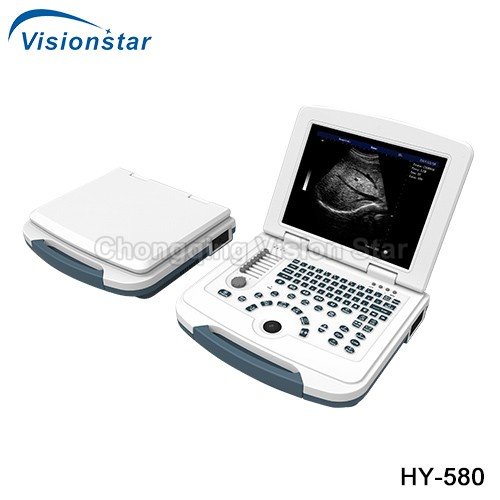 HY-580 Full-Digital Laptop Portable Ultrasound Machine