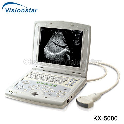 KX-5000 B Mode Portable Laptop Ultrasound Machine