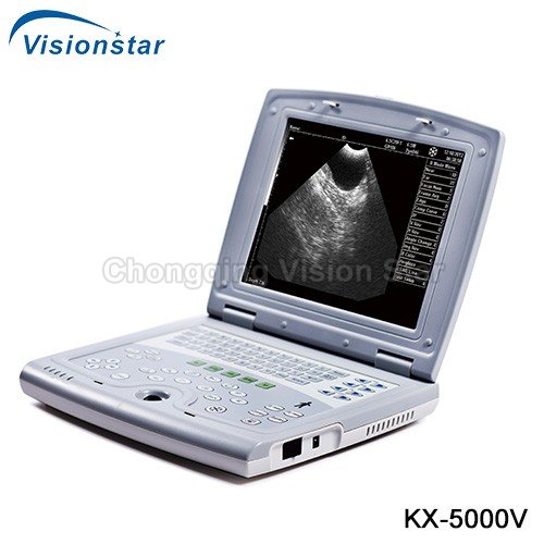 KX-5000V Veterinary B Mode Portable Ultrasound Machine