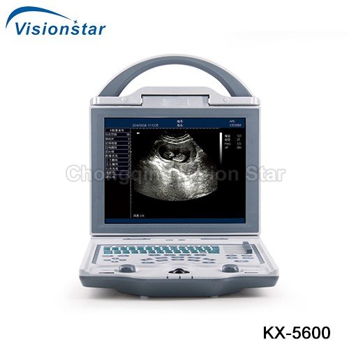 KX-5600 B Mode Ultrasound Machine