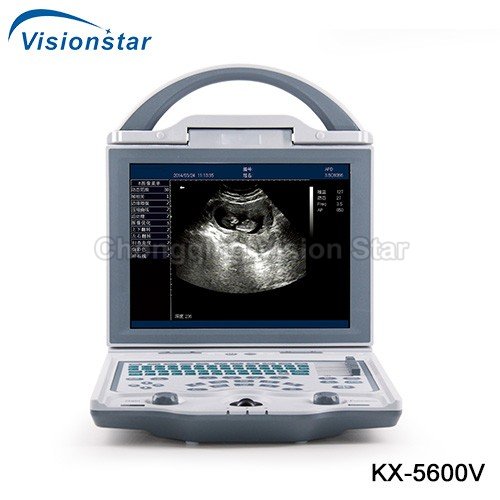 KX-5600V B Mode Veterinary Ultrasound Scanner
