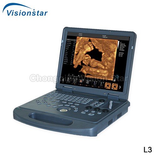 L3 Laptop Color Doppler 4D Portable Ultrasound Machine