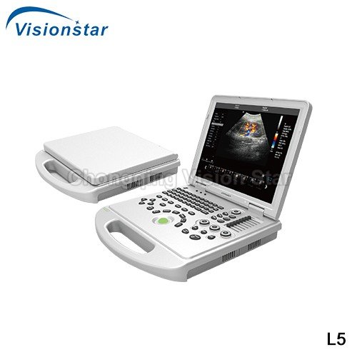 L5 Laptop 4D Color Doppler Portable Ultrasound Machine