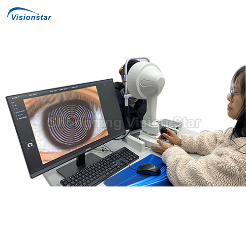 CT-9000 Corneal Topographer CT-9000 Corneal Topographer