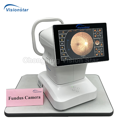 RC4000 Fundus Camera RC4000 Fundus Camera
