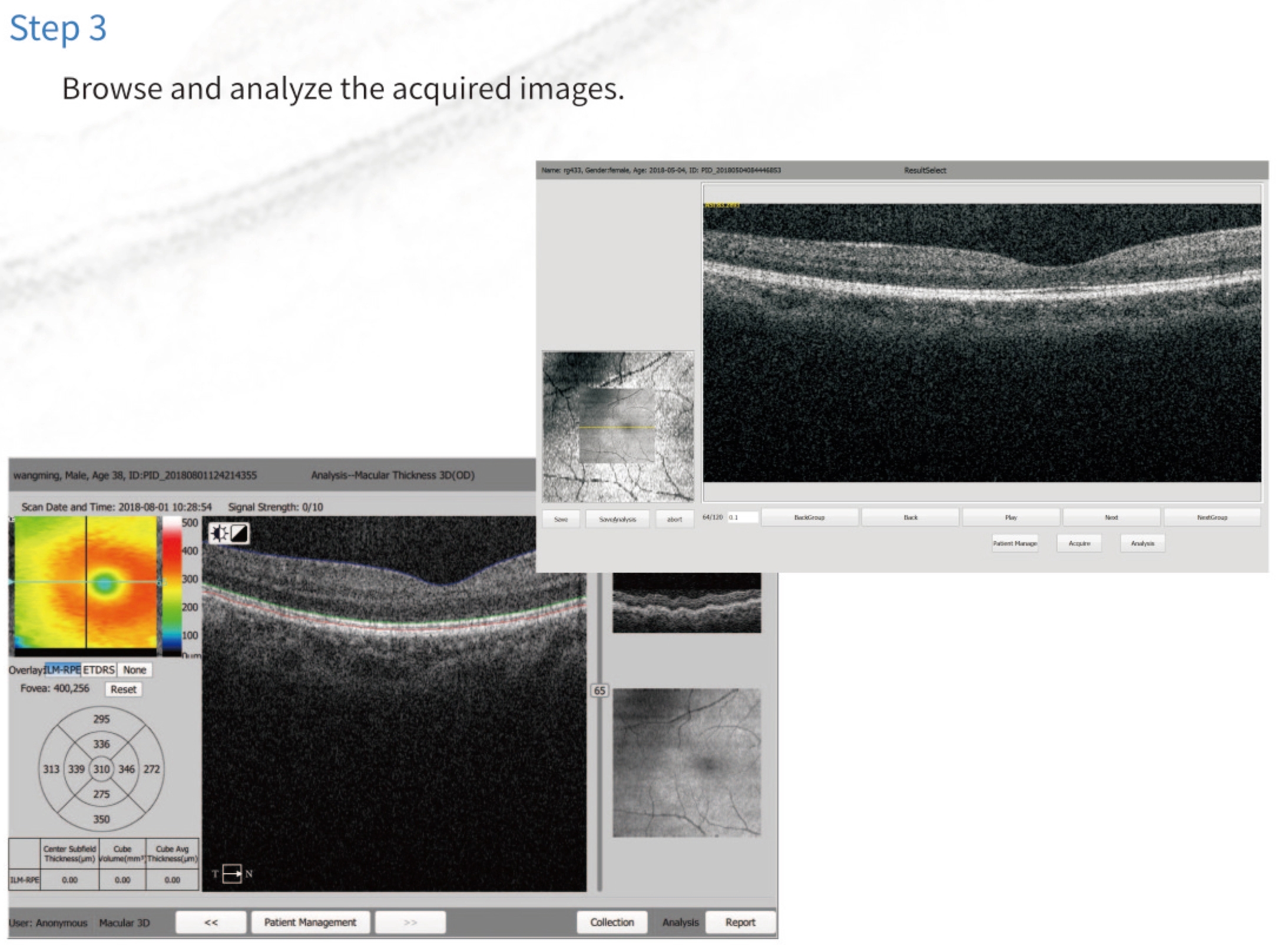 OCT-500 Optical Coherence Tomography