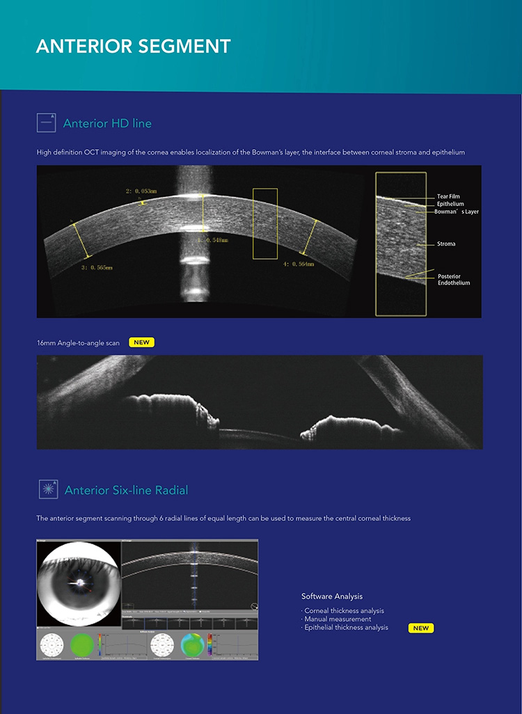 OSE-4000 Optical Coherence Tomography