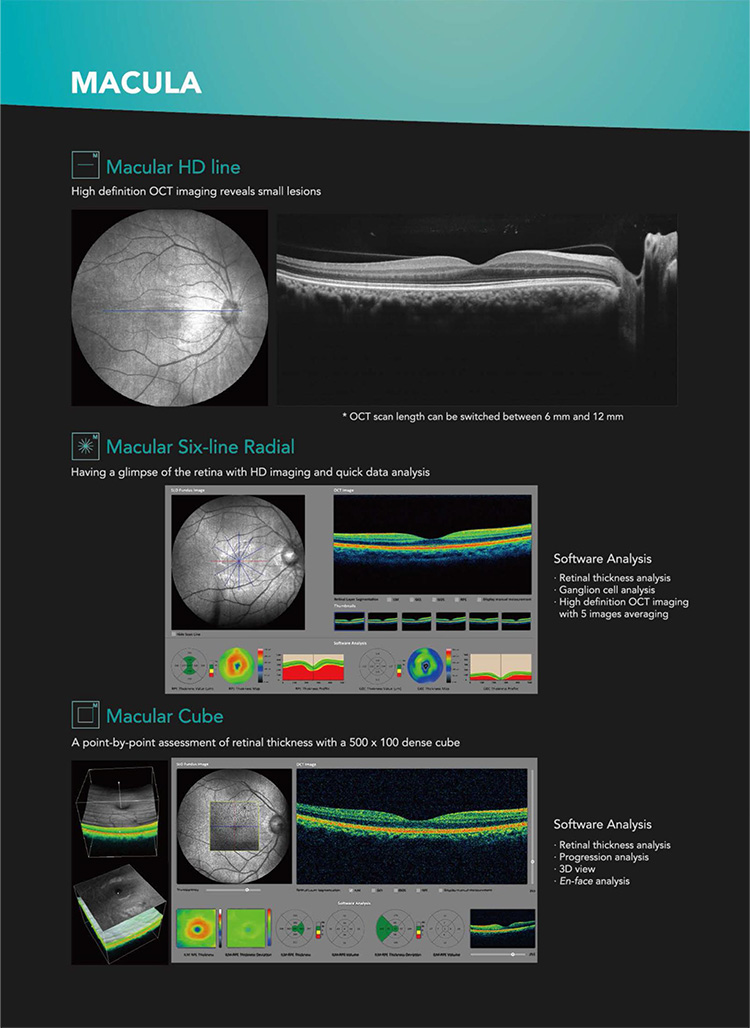 OSE-3000 OCT Optical Coherence Tomography