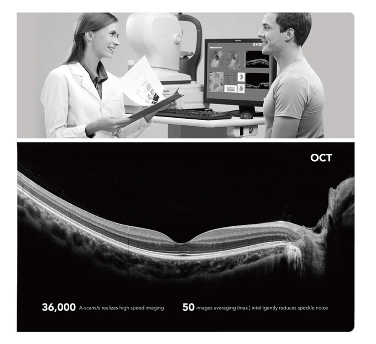 OSE-3000 OCT Optical Coherence Tomography