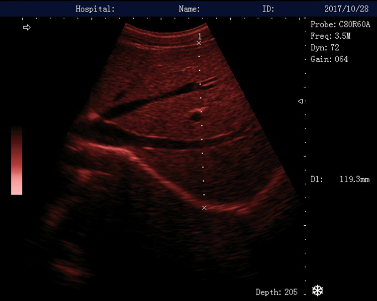 DW-580 B Mode Ultrasound Scanner