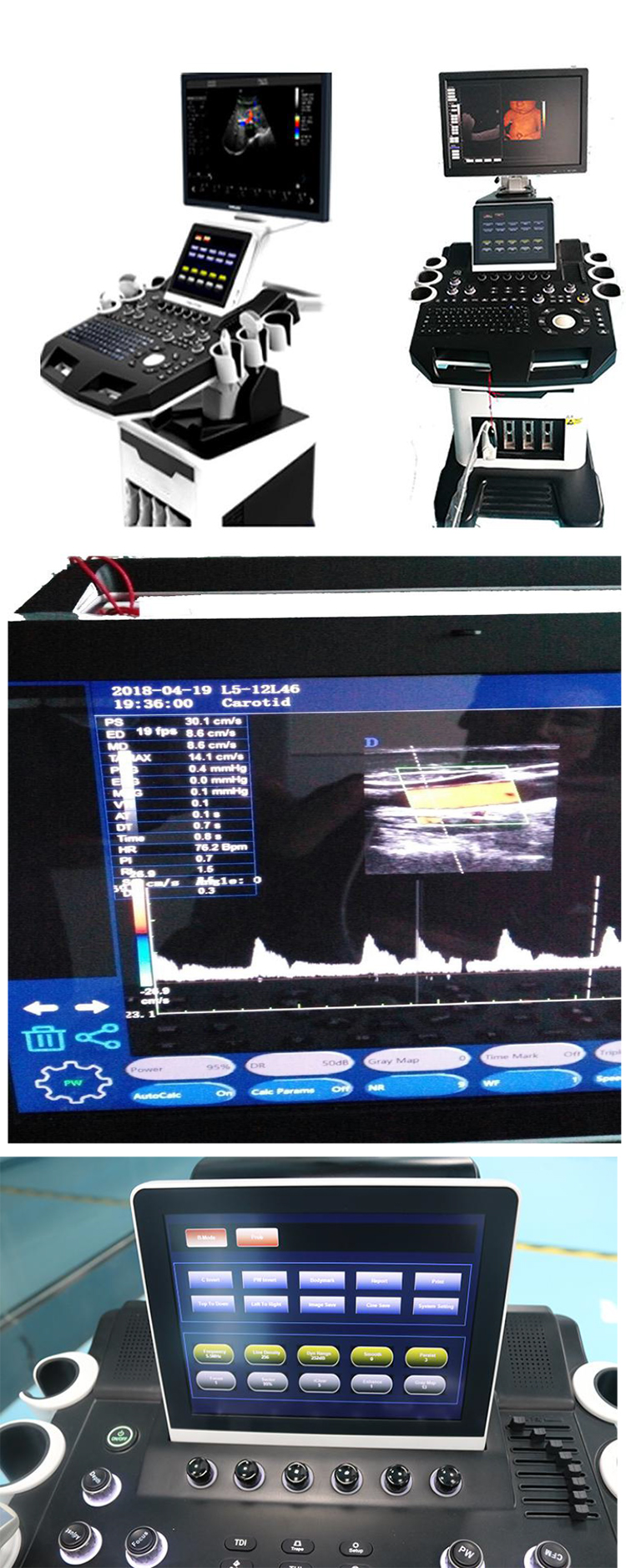 DW-T5 4D Ultrasound Machine
