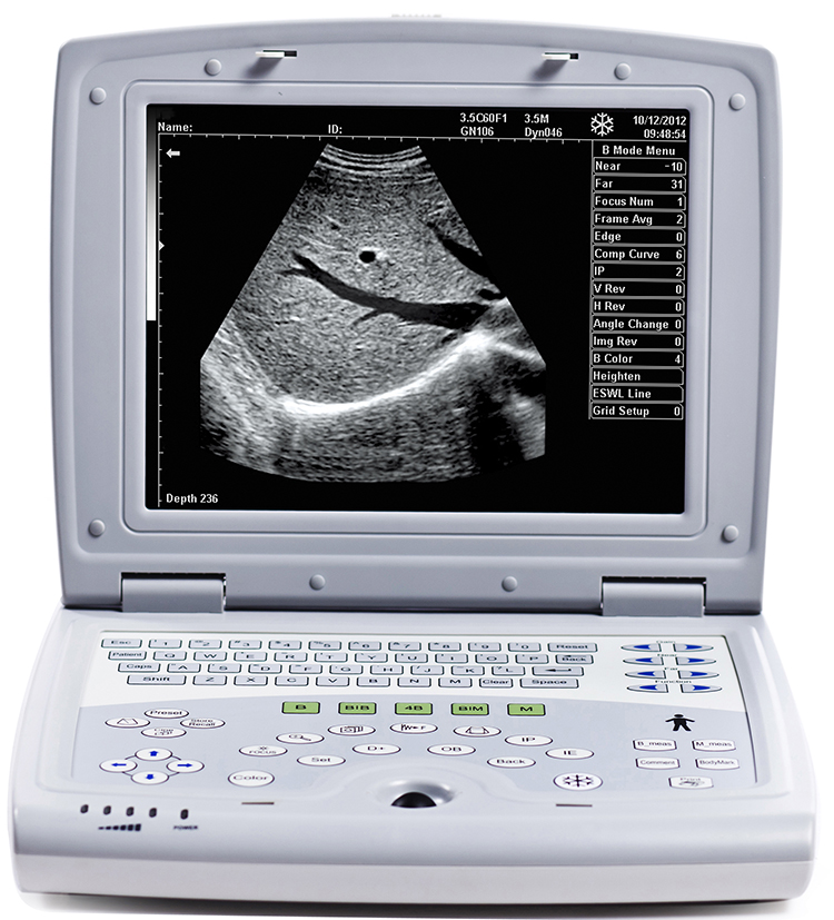 KX-5000 B Mode Ultrasound Machine
