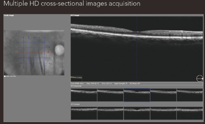 OSE-2800 OCT Optical Coherence Tomography