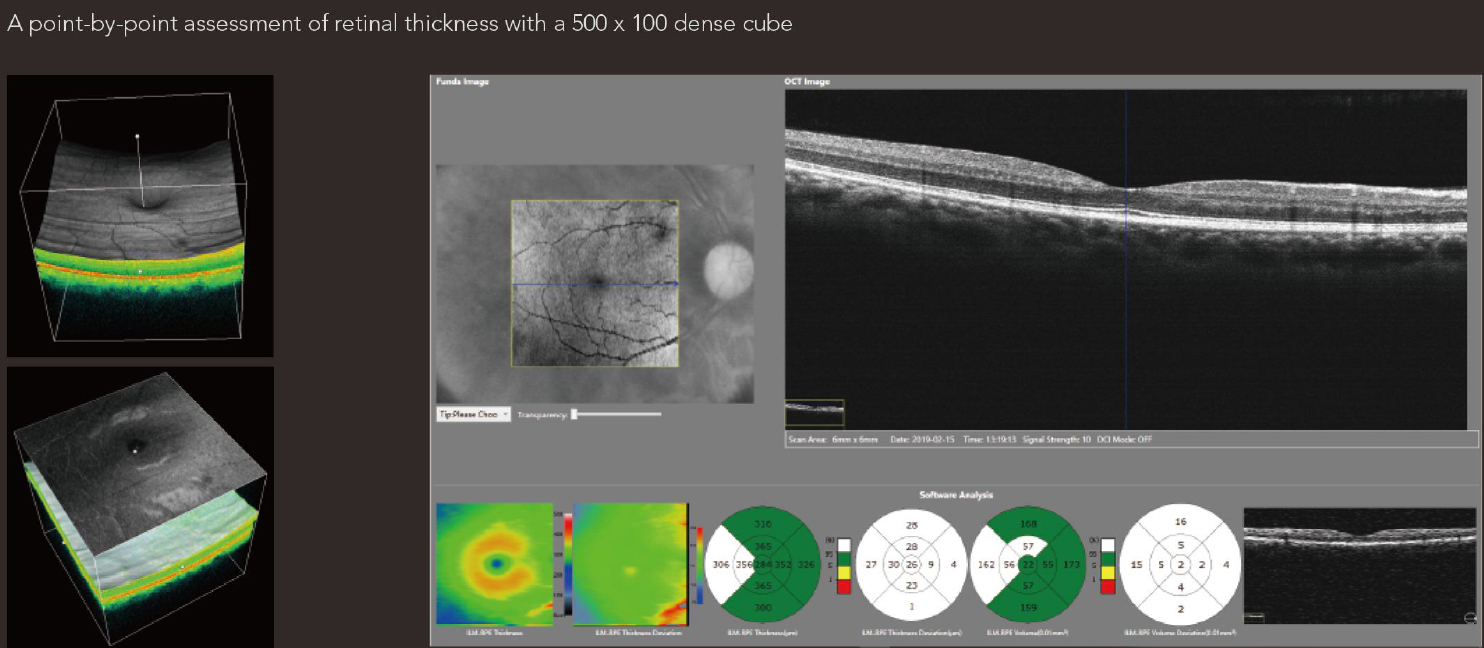 OSE-2800 OCT Optical Coherence Tomography
